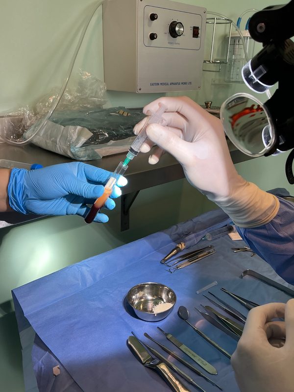 Equipo medico realizando un procedimiento odontologico con tejido oseo donado en el hospital